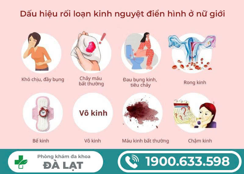 Hình ảnh minh họa